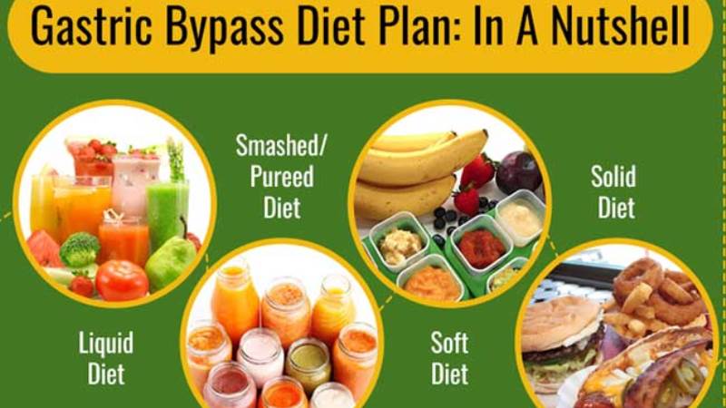 Phases Of Diet Post a Gastric Bypass