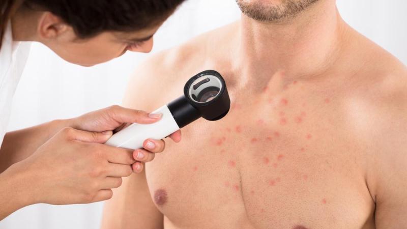 Body Acne Treatment: The Large Number Of Selections