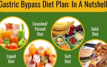 Phases Of Diet Post a Gastric Bypass