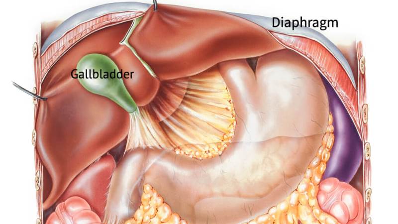 How Long Does A Gallbladder Attack Last